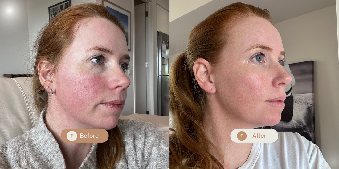 Pigmentation: Why Your Skin’s Acting Up -  And How Nature Has the Answer